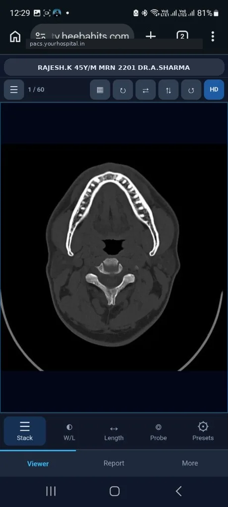 HEEBA mobile clinical viewer — stack scroll (demo patient Rajesh K)