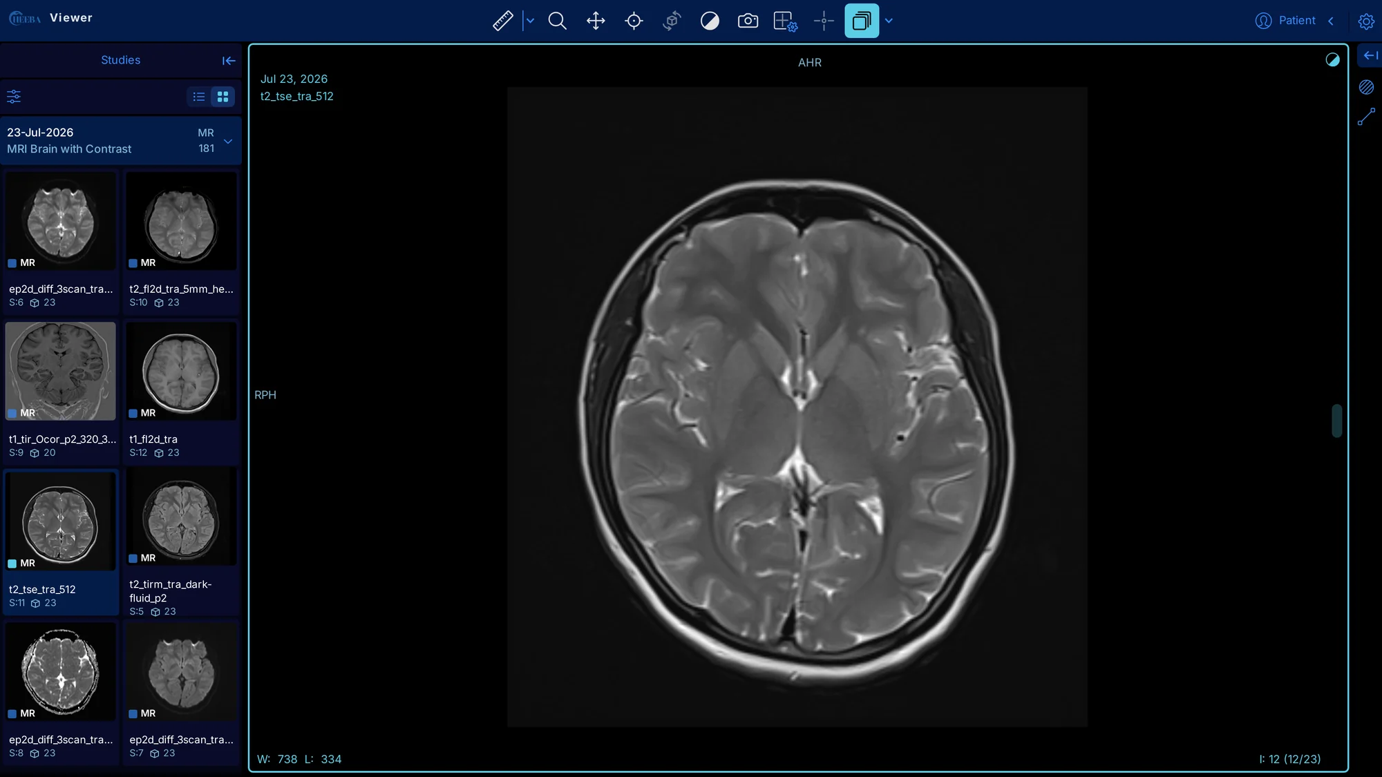 HEEBA Viewer displaying an MRI brain study