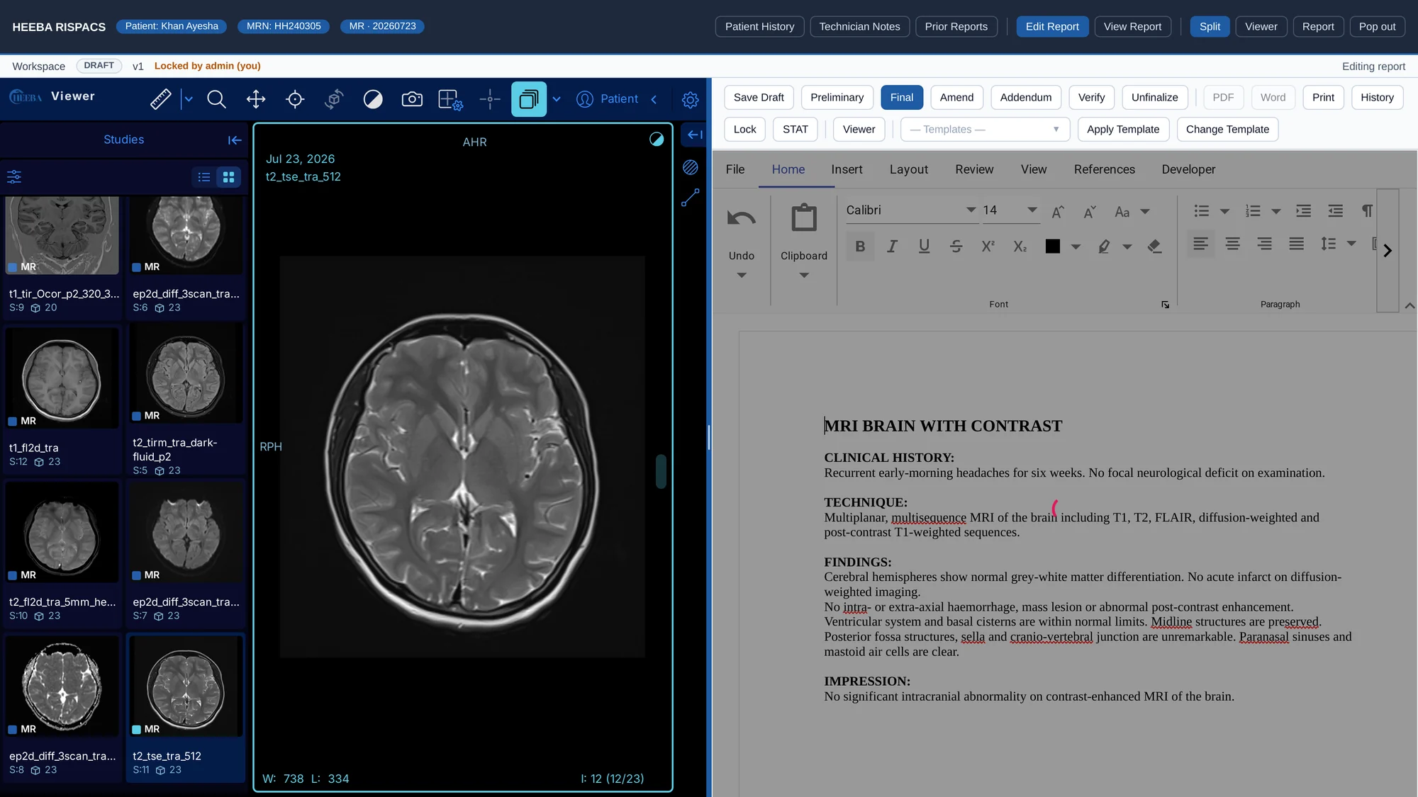 HEEBA reading workspace — viewer and report side by side